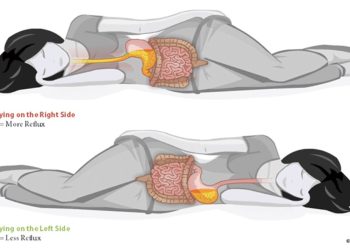 ГОРУШИЦА, НАДУТОСТ И НЕМИРАН САН: ЕВО КОЈА ХРАНА ЈЕ НАЈЧЕШЋА ГРЕШКА ПРЕД СПАВАЊЕ