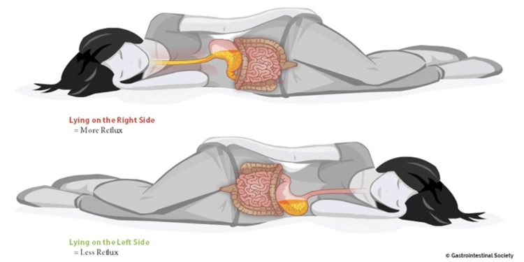 ГОРУШИЦА, НАДУТОСТ И НЕМИРАН САН: ЕВО КОЈА ХРАНА ЈЕ НАЈЧЕШЋА ГРЕШКА ПРЕД СПАВАЊЕ