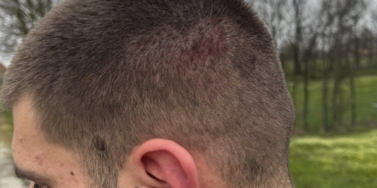 Блокадери покушали да убију активисту СНС!